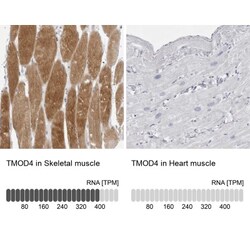 Tropomodulin 4 Antibody, Novus Biologicals:Antibodies:Primary Antibodies